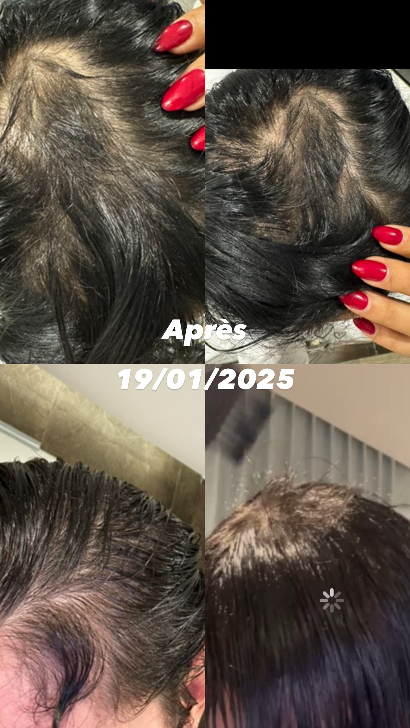 MHSA ÉDITION LIMITÉE EN PRÉCOMMANDE