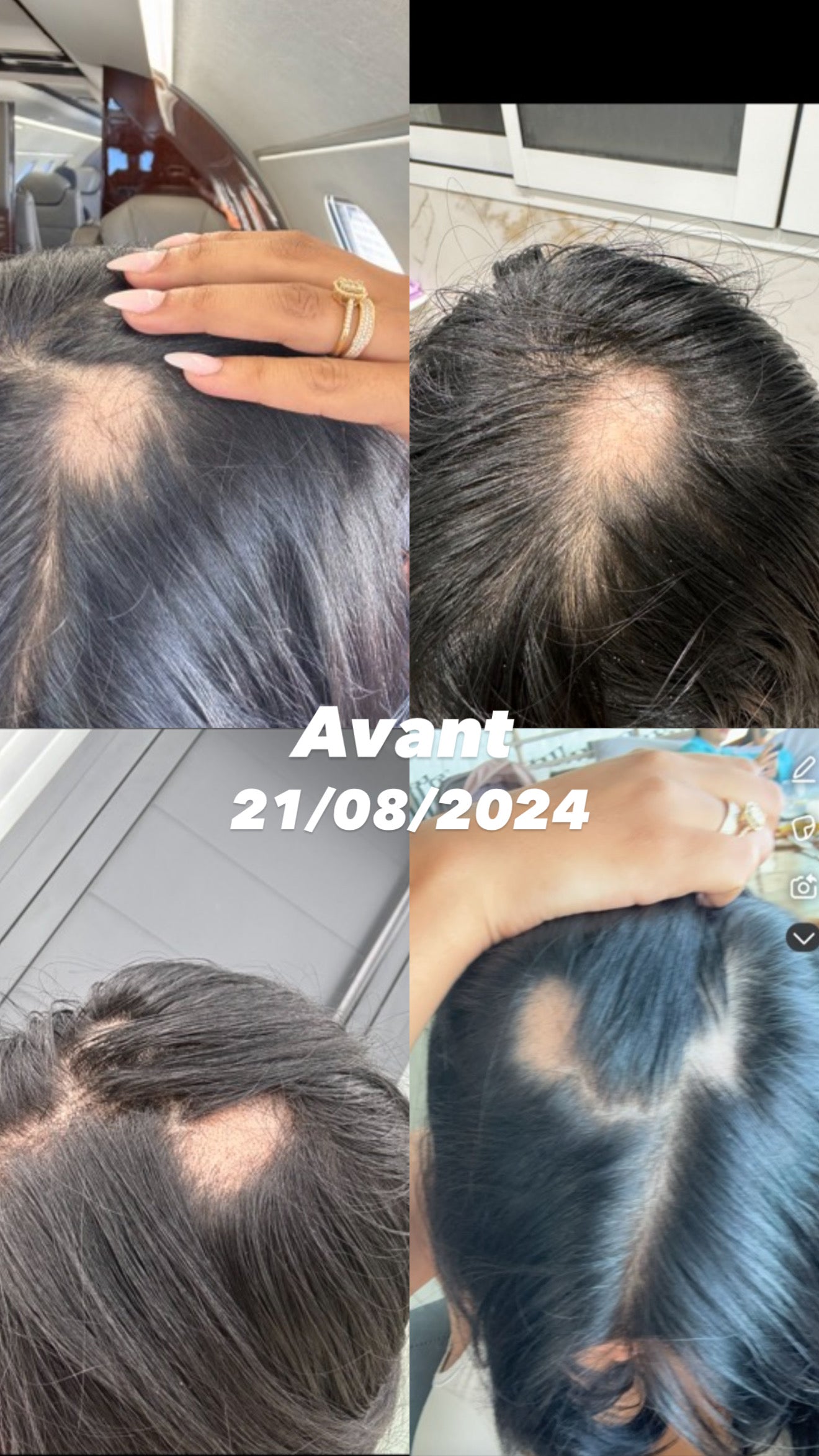 MHSA ÉDITION LIMITÉE EN PRÉCOMMANDE